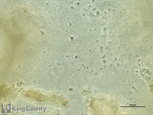 Photo of Coscinodiscus spp.